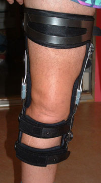 knee brace